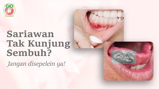 Download Lagu Kenali Gejala Kanker Lidah : Sariawan yang Membandel