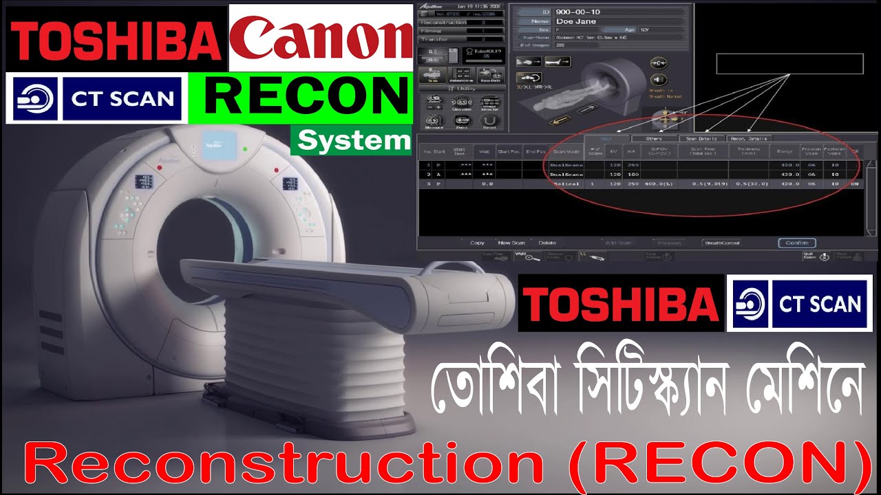Video No:29. HOW TO  RECONSTRUCTION IN TOSHIBA 160 CT MACHINE.