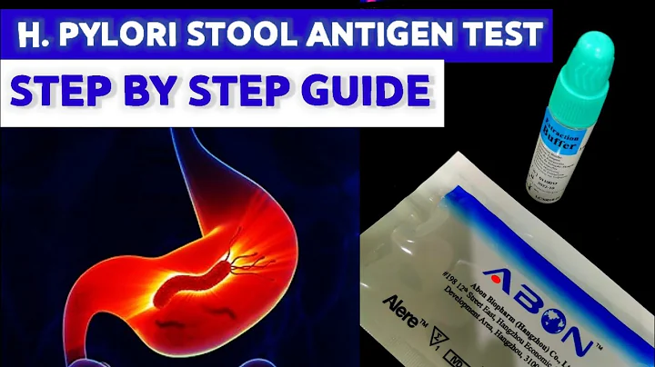 Helicobacter pylori Stool Antigen Test| MEDICAL LABORATORY SCIENCE