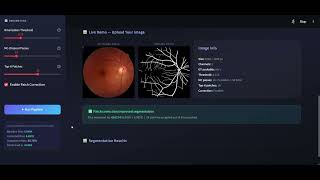 Famous Retinal Vessel Segmentation With Patch Correction demo video Wealth