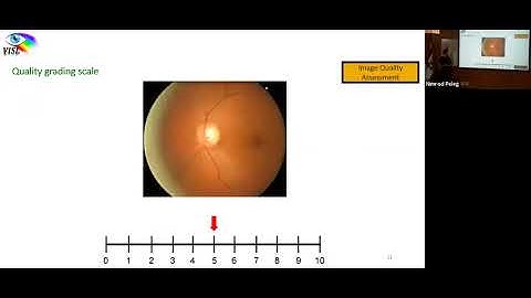 End-to-end Deep Learning Model for Automated Glaucoma Diagnosis