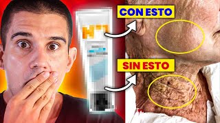 ¡ASOMBROSAS DIFERENCIAS!La MEJOR CREMA ANTIARRUGAS ES ESTA