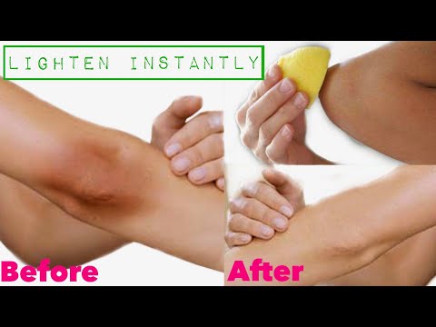 HOW TO LIGHTEN ELBOWS AND KNEES FAST AND NATURALLY | DIY Treatment + Paste (100% Works!!)