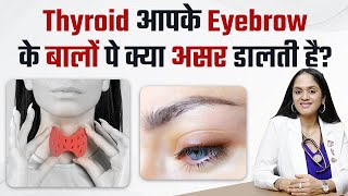 Thyroid आपके Eyebrow के बालों पे क्या असर डालती है? | Thyroid Eyebrow Hair Loss