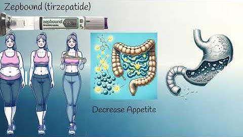 Revolutionary Approach to Weight Loss -  Zepbound (tirzepatide)  Explained