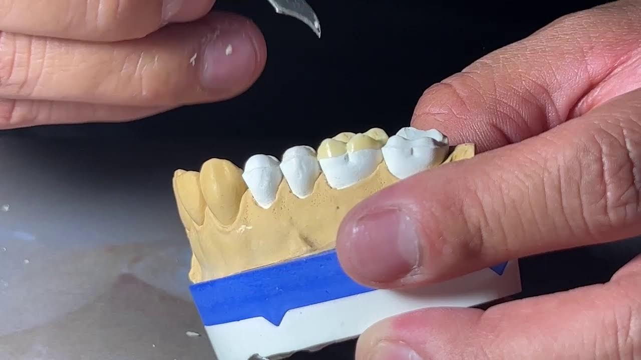 Curso Máster de Encerado