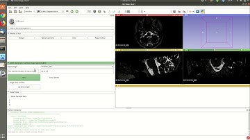 Automatic Cochlea Image Segmentation and Analysis