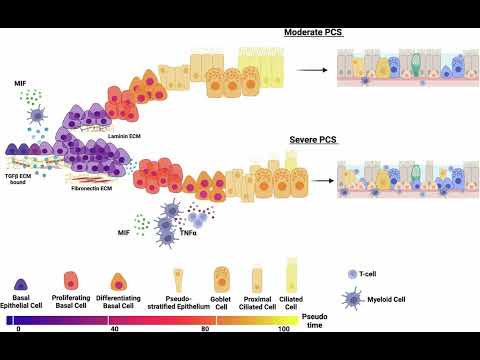 Нове дослідження пов’язує запалення носа з довгостроковими симптомами у пацієнтів, які перенесли COVID