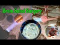 Unexpected brain salad surgery vortex marble build episode 16