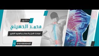 مرض التصلب المتعدد