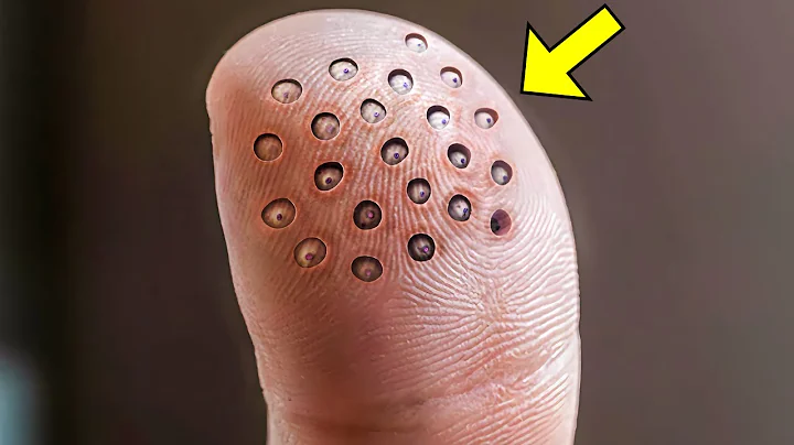 These Weird Spots Suddenly Appeared on His Finger....