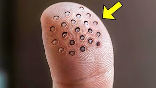 These Weird Spots Suddenly Appeared on His Finger. When the Doctors Saw It, They Called the Police!