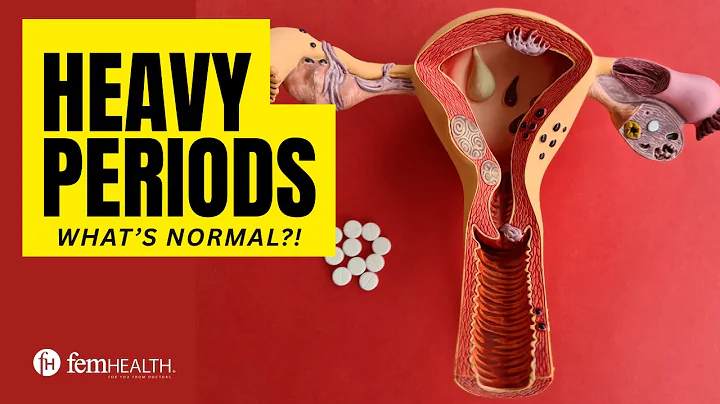 Is Your Period Normal?! Or Is It Heavy Menstrual Bleeding? Excessive Heavy Bleeding In Periods