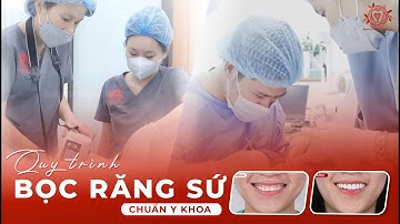 Bọc Răng Sứ Thẩm Mỹ Thế Nào Là Đẹp? Quy Trình Bọc Răng Sứ Chuẩn Sẽ Ra Sao? | Nha khoa Sdental