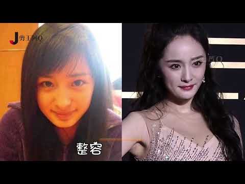 女星整容前后，陶虹“放入假体”逆袭巅峰，鞠婧祎“削骨”成神颜