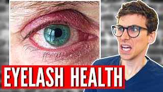 Why You NEED to Wash Your EYELASHES  5 Tips for Blepharitis