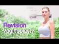 After 2 Failed Surgeries… I Finally Vaginoplasty Revision (Colon Technique) | Guiliana’s Story