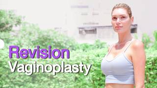 After 2 Failed Surgeries I Finally Vaginoplasty Revision Colon Technique Guilianas Story