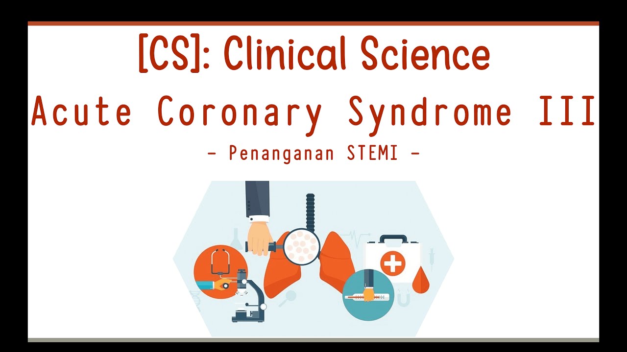 Sindrom Koroner Akut (SKA atau ACS) Bagian 3: Penanganan STEMI
