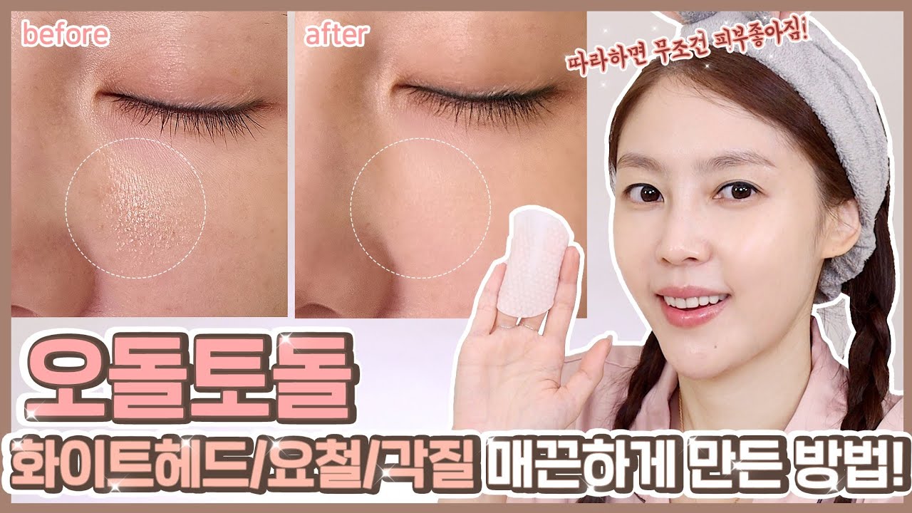 따라하면 무조건 피부좋아짐! 오돌토돌 화이트헤드/요철/각질 매끈해지는 방법! 인생템 추천! - YouTube