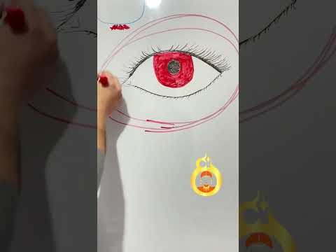 عن قول رسول الله صلى الله عليه و سلم العين حق العين تدخل الرجل القبر و تدخل الجمل القدر 