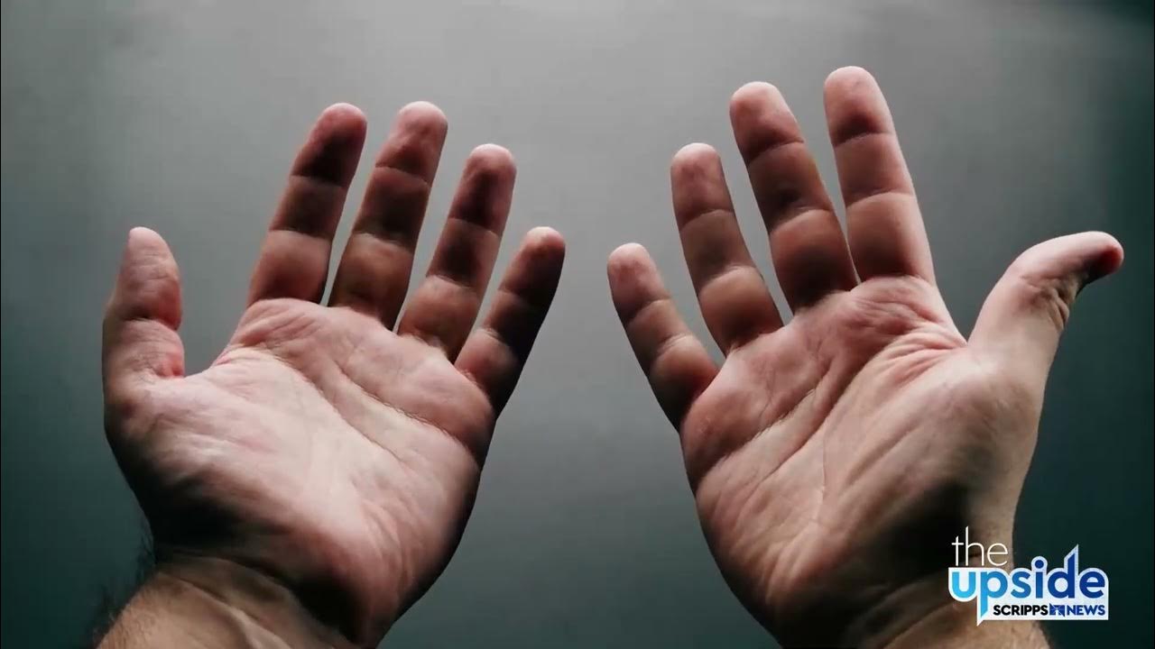 Why our hands get pruney when we spend time in the water YouTube