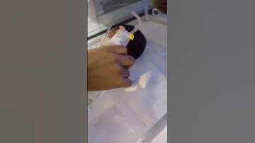 Neonate in 360° phototherapy Mechine-treatment of N. jaundice#newborn#neonataljaundice#phototherapy