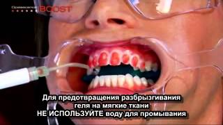 Отбеливание зубов Opalescence Boost (русские субтитры) Отбеливание зубов Opalescence Boost (русские субтитры)