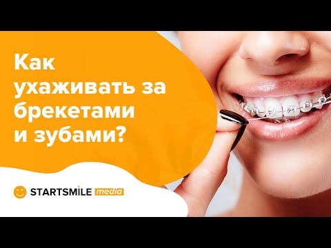 5 правил ухода за брекетами. Как чистить брекеты?