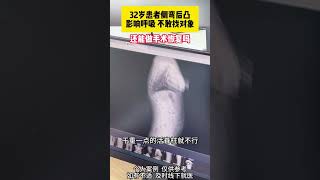 32岁患者严重侧弯，找工作受影响，找对象受影响 脊柱侧弯 脊柱健康 脊柱 门诊日常