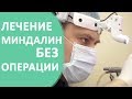 Криотерапия ⛄ Как криотерапия поможет навсегда избавиться от хронического тонзиллита?