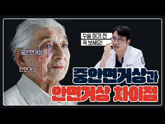 중안면거상 안하고 안면거상만으로 해결할 수는 없나요? (faet. 하안검 수술)