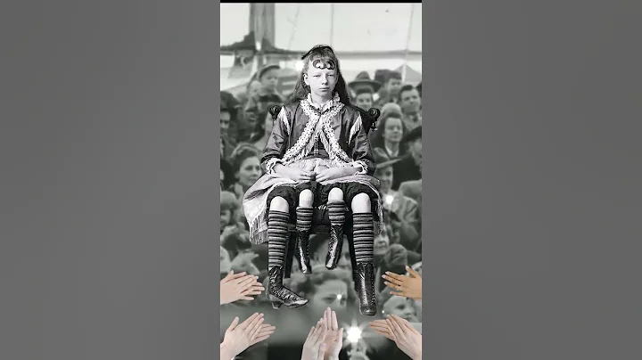 TRUE STORY of GIRL with 4 LEGS!  Myrtle Corbin | D...