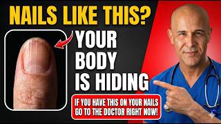 Detailed Doctors Are Shocked: If Your Nails Look Like This, Your Body May Be Hiding 4 Serious Diseases Profile