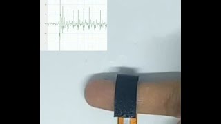 A soft robotic finger for ECG measurement screenshot 2