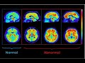 Tracers in Ionizing Radiation | Biomedical Image Processing | SNS Institutions