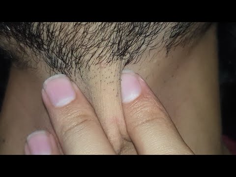 Asmr Beard hair Satisfying | Massage therapy hair Satisfying | Scratching hair sounds