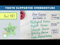tooth supported overdenture