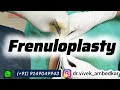 Frenuloplasty | Tight Frenulum | Ling ki Seal ki Surgery | लिंग की सील की सर्जरी