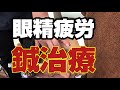 眼精疲労に鍼治療|眼窩内刺鍼