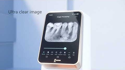the PSP Scanner dental i-Scan of Woodpecker