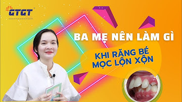 Làm gì khi răng bé mới mọc lên đã lệch lạc? I Nha khoa GTGT