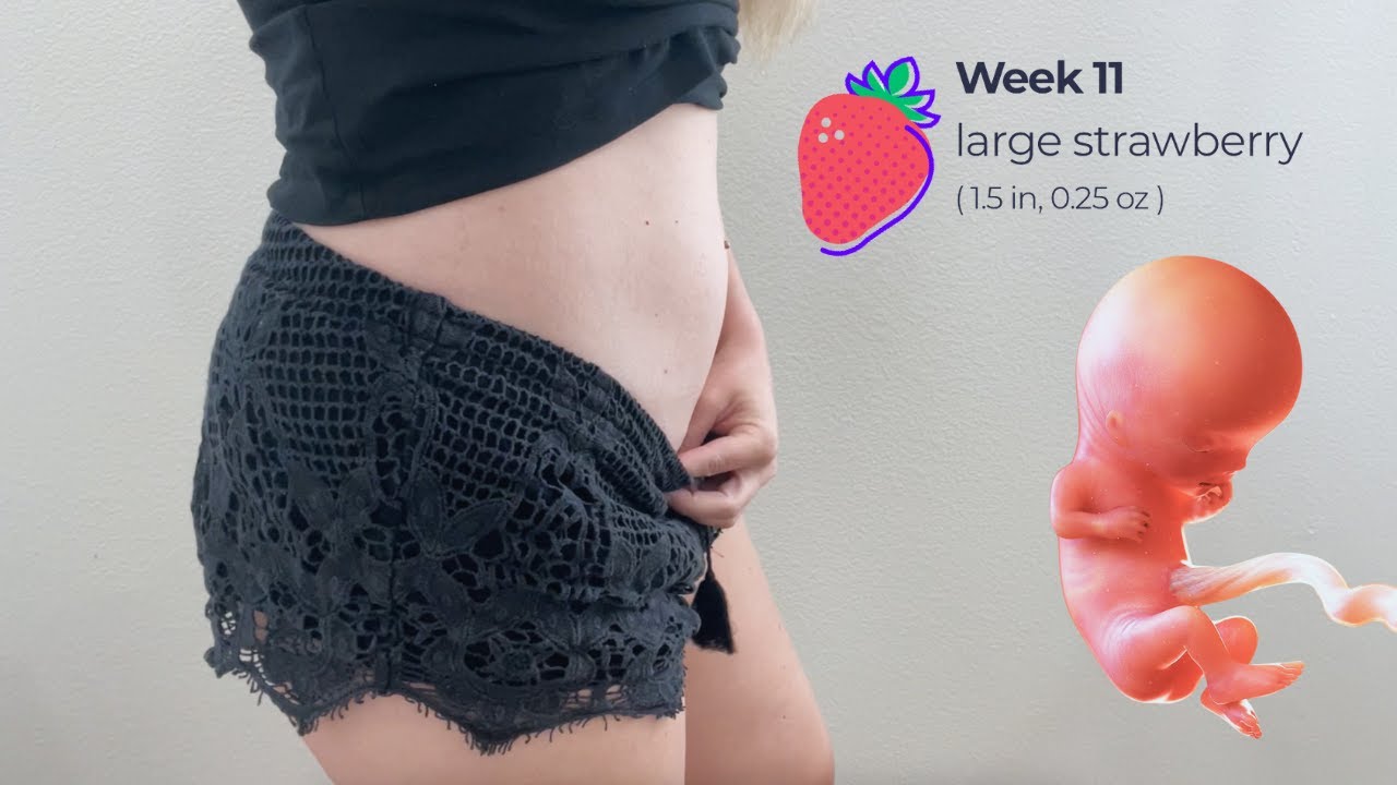11 Week Pregnancy Symptoms & Second OB Appointment What to Expect - YouTube