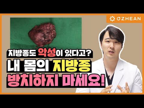 당신의 지방종이 악성일 확률. 내 몸의 혹 지방종 방치하지 마세요 악성지방종 지방육종 [성형 알려주는 남자 이용석]