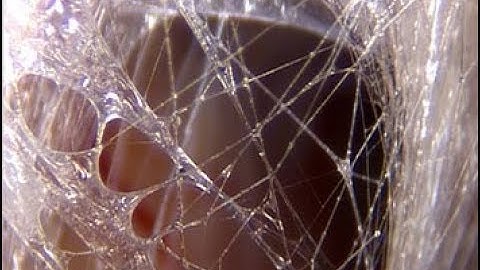 What is Fascia?