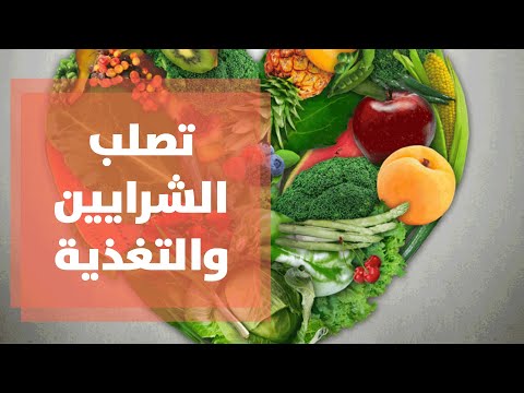 فيديو: البروكلي ضد تصلب الشرايين