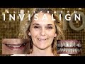 INVISALIGN Cross-bite - AMAZING Accelerated Smile Makeover in 7 MONTHS - EP 04