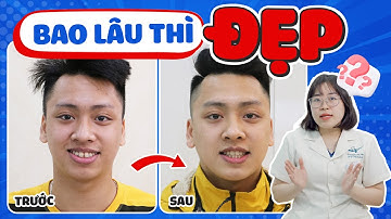 3 Cách Rút Ngắn Thời Gian Niềng Răng Cực Kỳ Hiệu Quả, 100% Thành Công Tháo Niềng Sớm