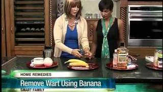 Use a banana peel to remove warts? Surprising home remedies