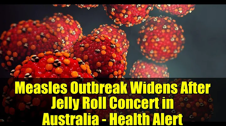 Measles Outbreak Widens After Jelly Roll Concert in Australia - Health Alert